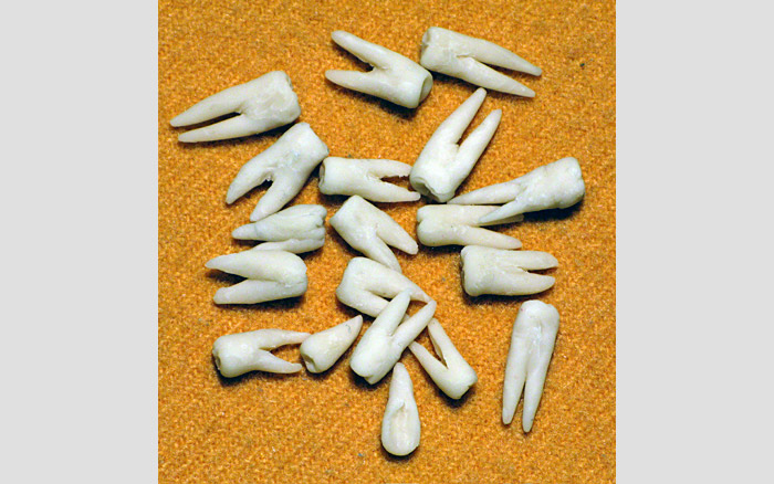 Salt of the Earth | Hand cast teeth (process), 2009